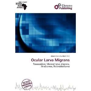  Ocular Larva Migrans (9786200968470) Adam Cornelius Bert Books