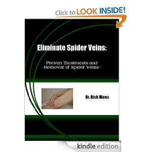 Eliminate Spider Veins Proven Treatments and Removal of Spider Veins 