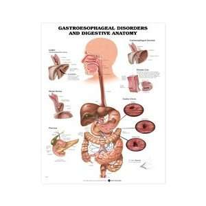 Gastroesophageal Disorders and Digestive Anatomy Anatomical Chart, 2nd 