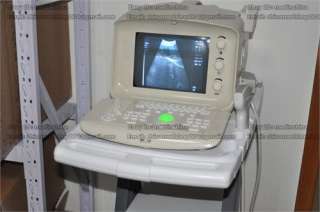 Trolley Cart for Portable Ultrasound scanner  